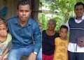 Buche, Bocah Penderita Tumor di Wajah Asal Oelpuah Kini Sehat