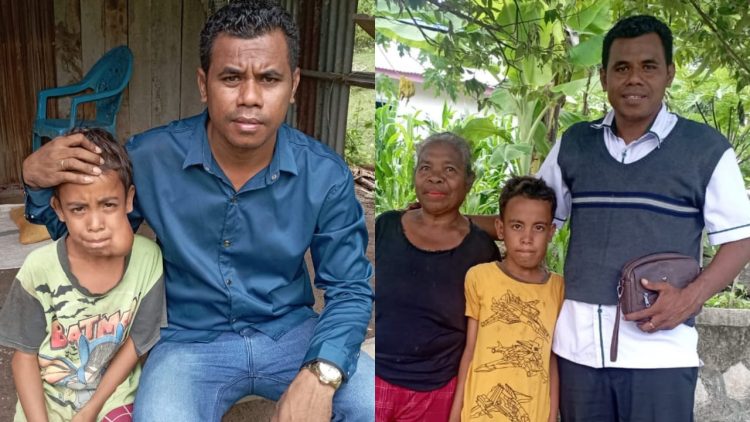 Buche, Bocah Penderita Tumor di Wajah Asal Oelpuah Kini Sehat