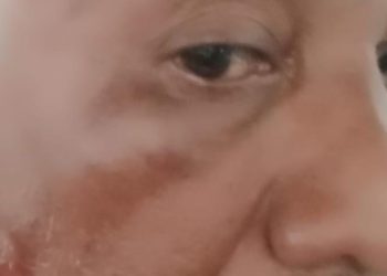 Rentetan Kronologis Kejadian Misteri Rapat Internal DPRD Kabupaten Kupang Menggemparkan Masyarakat dan Menjadi Perhatian Publik