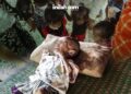 Fakta, Satu dari Lima anak di NTT Masih Mengalami Stunting